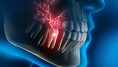 Kill Tooth Pain Nerve in 3 Seconds Permanently